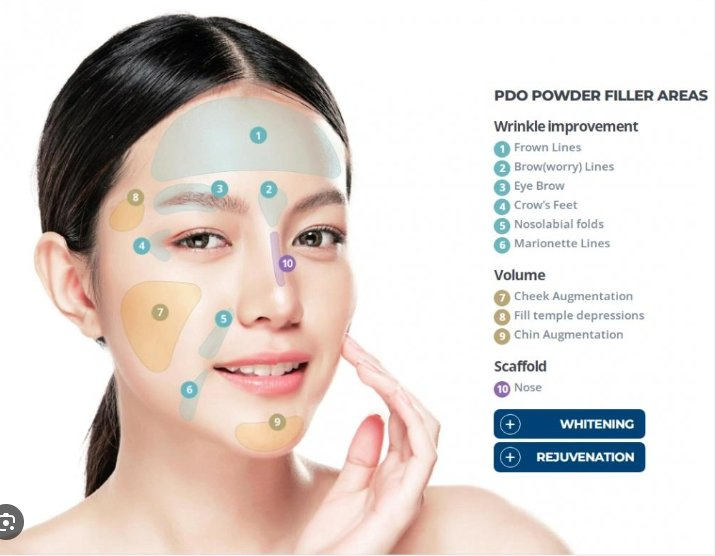 Korea Rejubella Pdo Filler Microspheres Collagen Production Injectable Collagen Stimulator Injectable Implant Remove Wrinkles