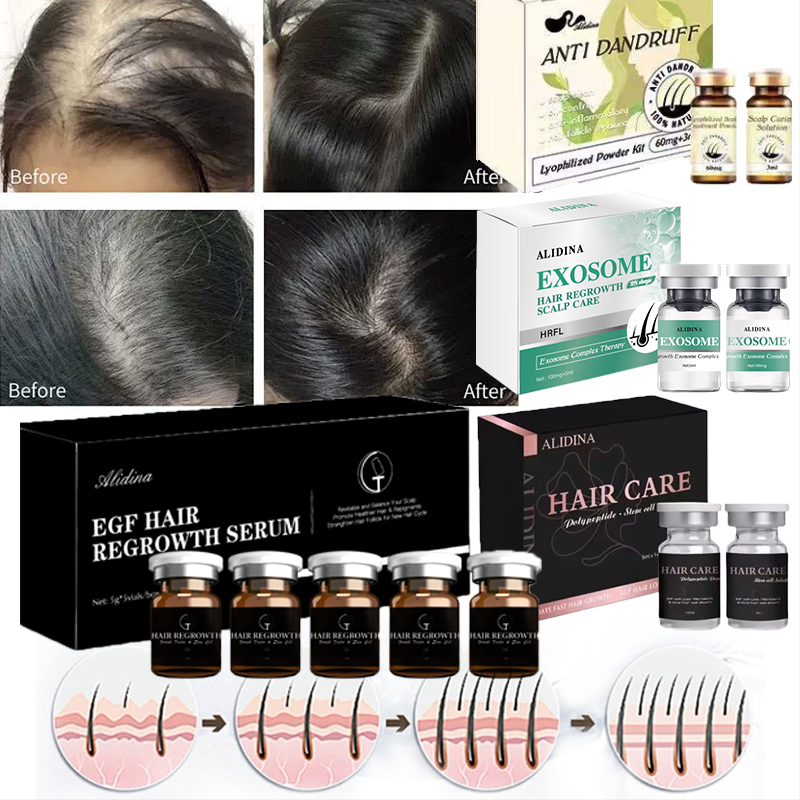 Hair Care Serum Scalp Care Serum Hair Care Freeze-Dried Powder Exosomas Polypeptide for Improve Bald Hair Repair Serum