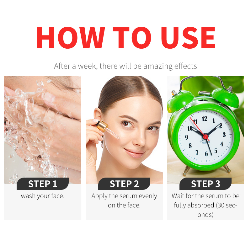 Reduce Acne Marks Repairing Shrink Pores Faded Spot Mandelic Acid Facial Serum