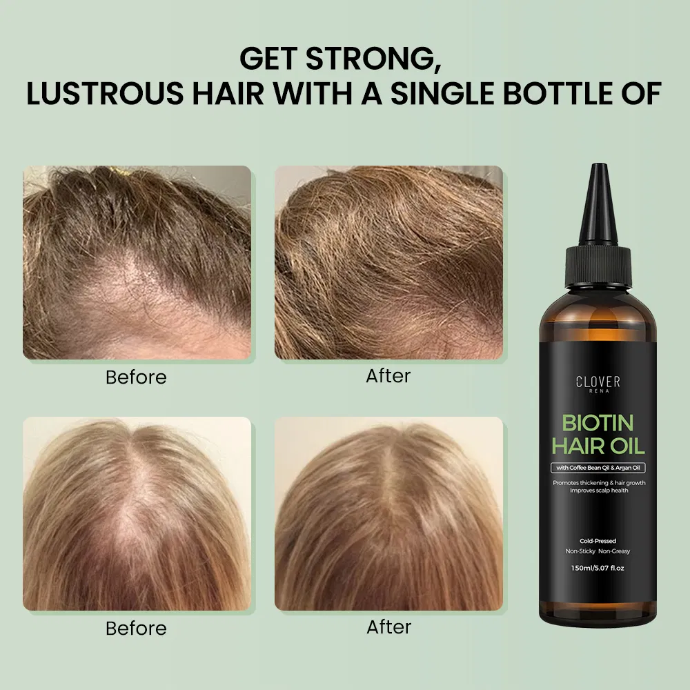 Private Label Hair Growth Hair Oil Best Natural Hair Growth Oil with Rosemary Castor