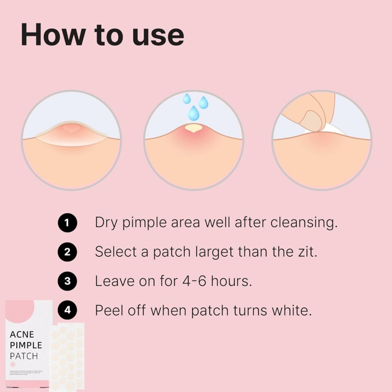 Manufacturers Wholesale Private Label Face Care Consumables Acne Patches Hydrocolloid Multi-Pattern Acne Patches Custom Acne Pimple Patches