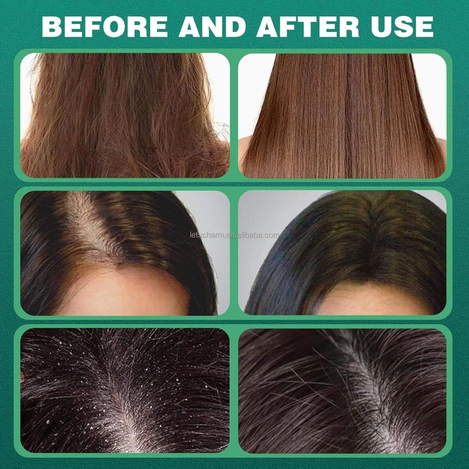 Ls133 Custom OEM/ODM Usman Grass & Cypress Leaf Scalp Care Soap Bars