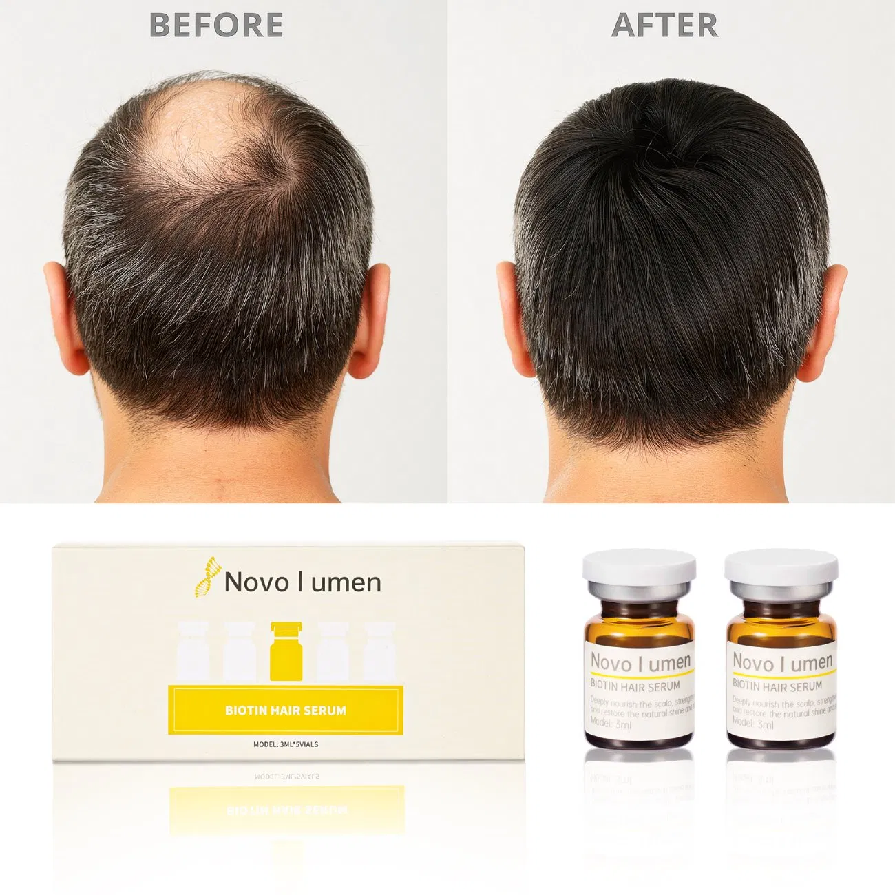 Fast-Acting Biotin Serum for Hair Growth and Volume Boost