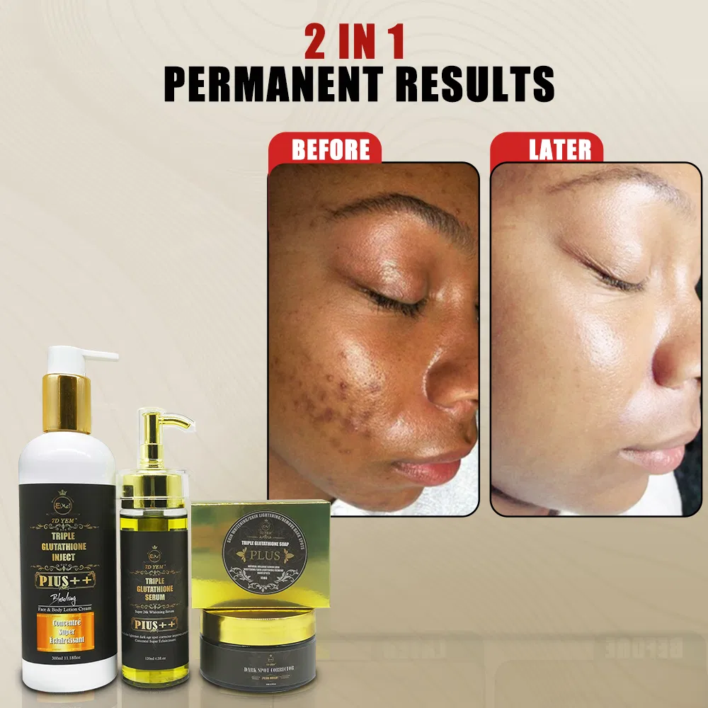 OEM Beauty Whitening Product Acne Dark Spot Removal Glutathione Skin Whitening Kit