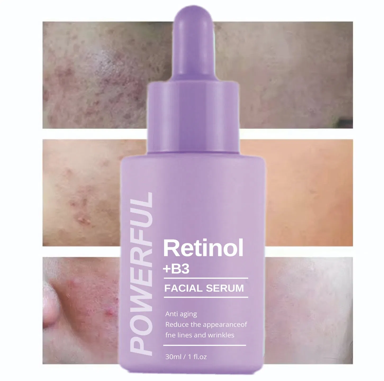 Beauty Skin Care Nourish Facial Vitamin Hydrating Serum Dry Skin Moisturizing Cosmetics