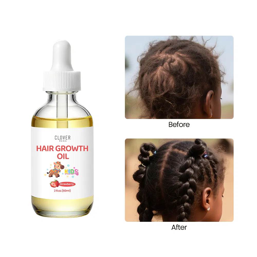 Natural Baby Kids Hair Care Products Extra Strength Growing Nourishing Children Hair Growth Grow Serum Oil Black Seed