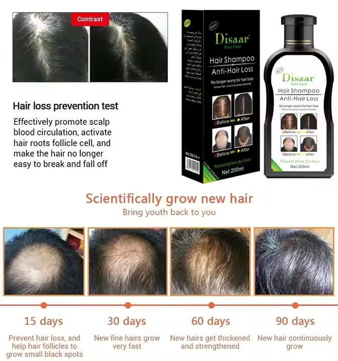 Natural Plant Hair Growth Shampoo Nourish Useful Hair Grow Shampoo