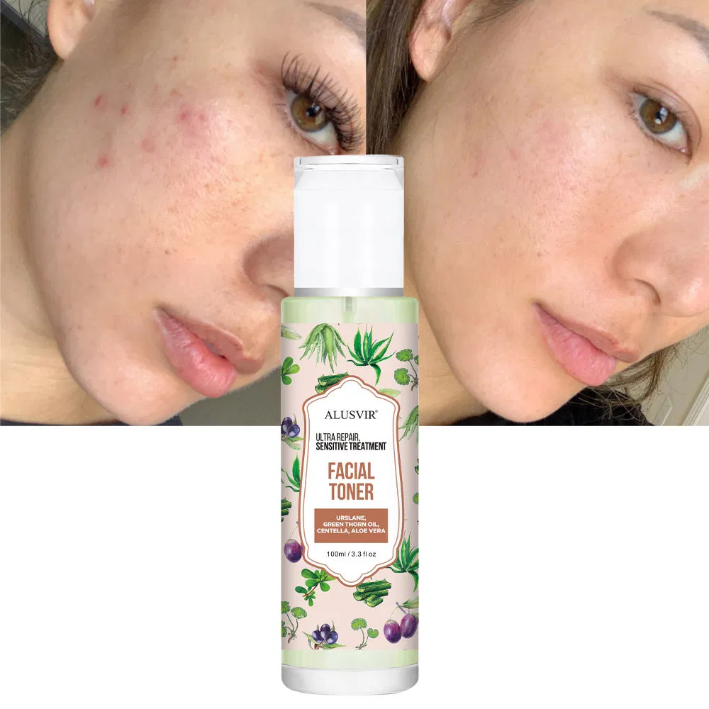 Sensitive Face Toner Redness Relief Anti-Allergy Hydrating Facial Toner