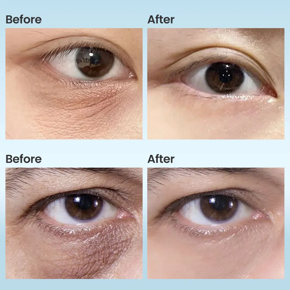 Revitalizing Firming Anti-Wrinkle Eye Capsules for Youthful Skin