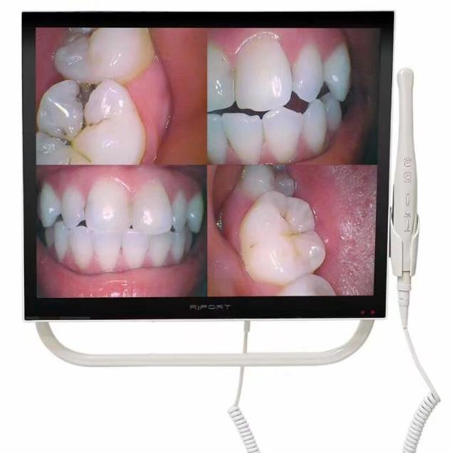 Simple Intraoral Camera and 17 Inch Dental Monitor to Dental Unit