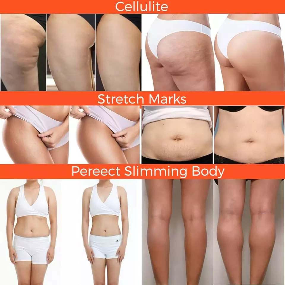 Ginger Jojoba Oil Anti-Cellulite Weight Loss Fat Burning Slimming Body Shaping Massage Lifting Firming Slimming Leg Body Waist Losing Fat Massage Body Cream