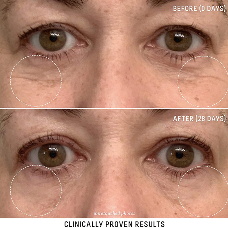 OEM/ODM Custom Squalane + Marine Anti-Aging Lifting Smoothing Eye Cream