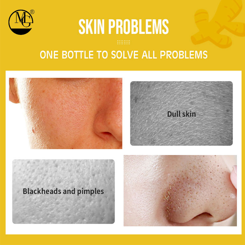 Brightening Dark Spots Antioxidant Essence Turmeric + Vitamin C Face Serum