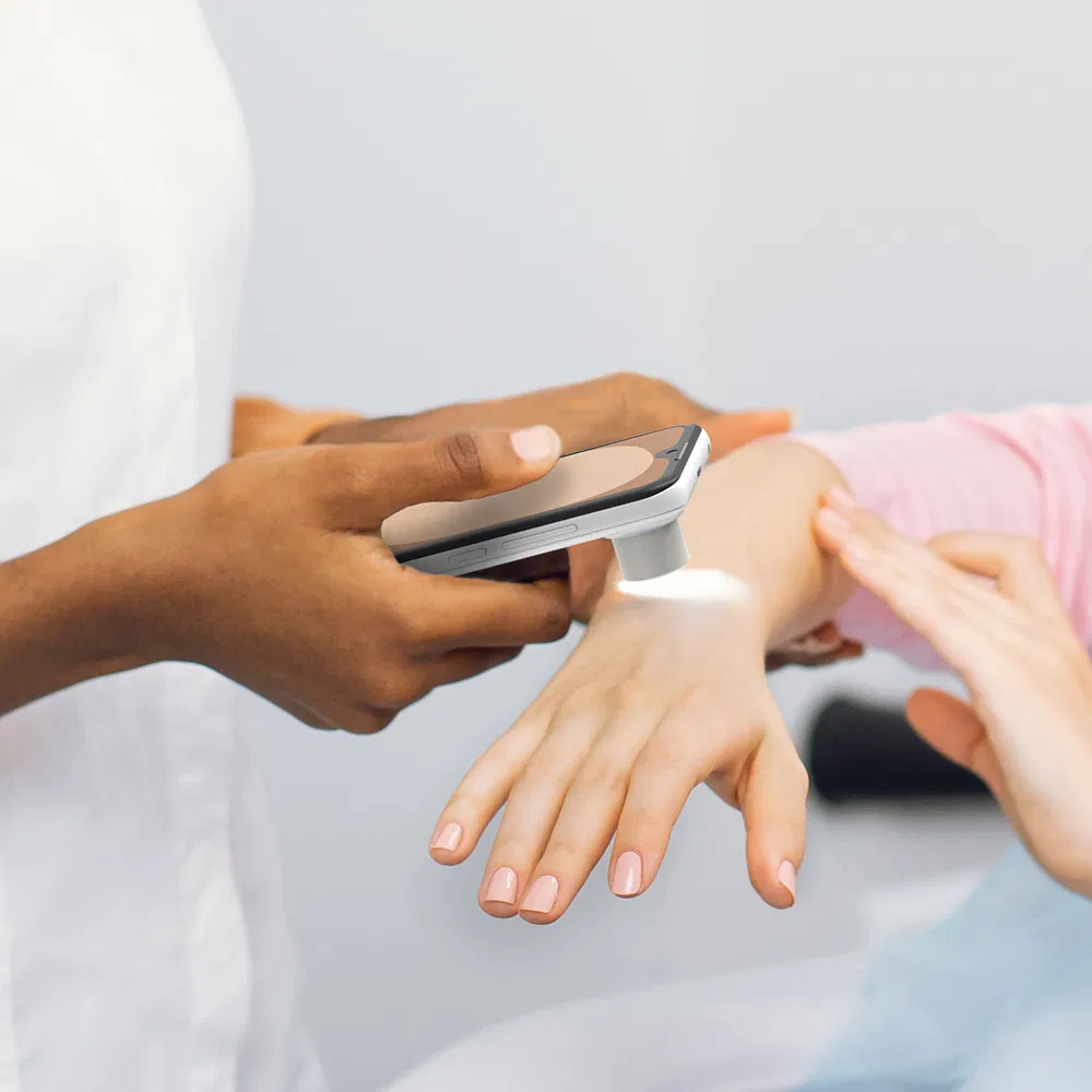 Портативный анализатор кожи 5 дюймов