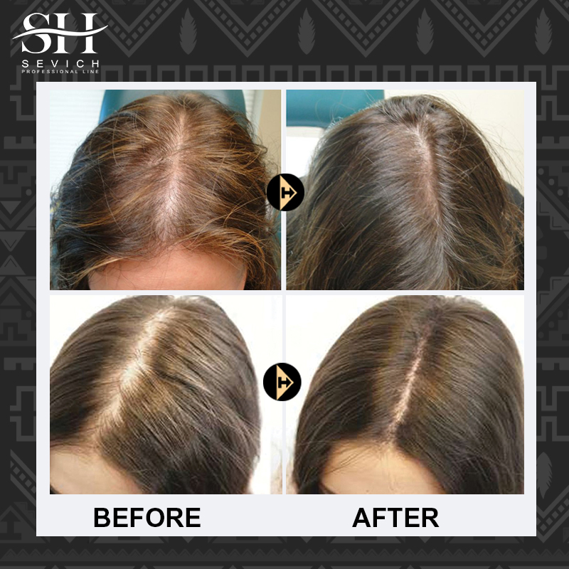High Quality Vegan Organic Rice Water Fast Thick Hair Growth Oil Spray