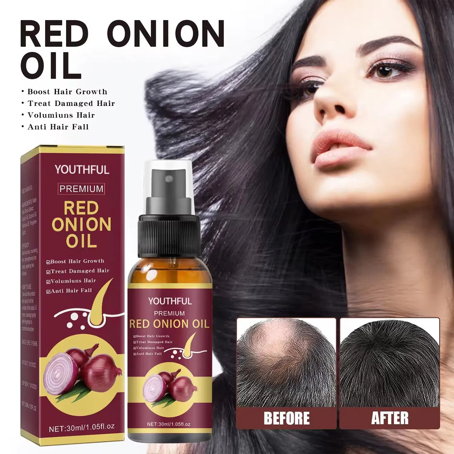 Hot Selling Red Onion Oil Hair Booster Oil