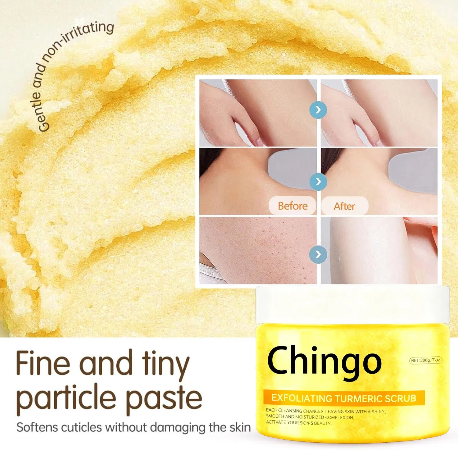 Keratosis Pilaris Scrub Smooth Bumps Exfoliate Moisturize