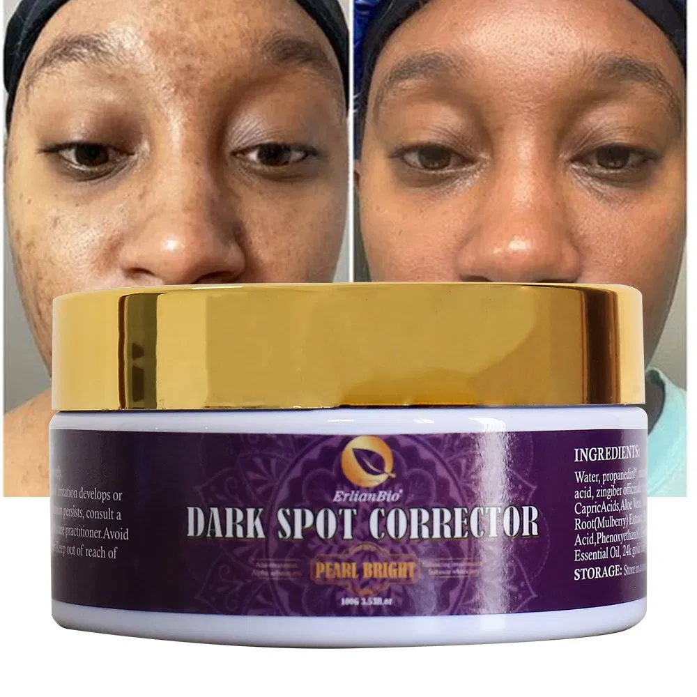 Whitening Hydrating Dark Spot Removal Face Cream Glutathione Collagen Brighten Anti Acne Skin Cream