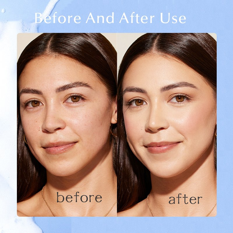 Salicylic Acid Acne Clear Face Wash Oil Control Whitening Exfoliating Anti Acne Deep Cleaning Skin Care Facial Cleanser