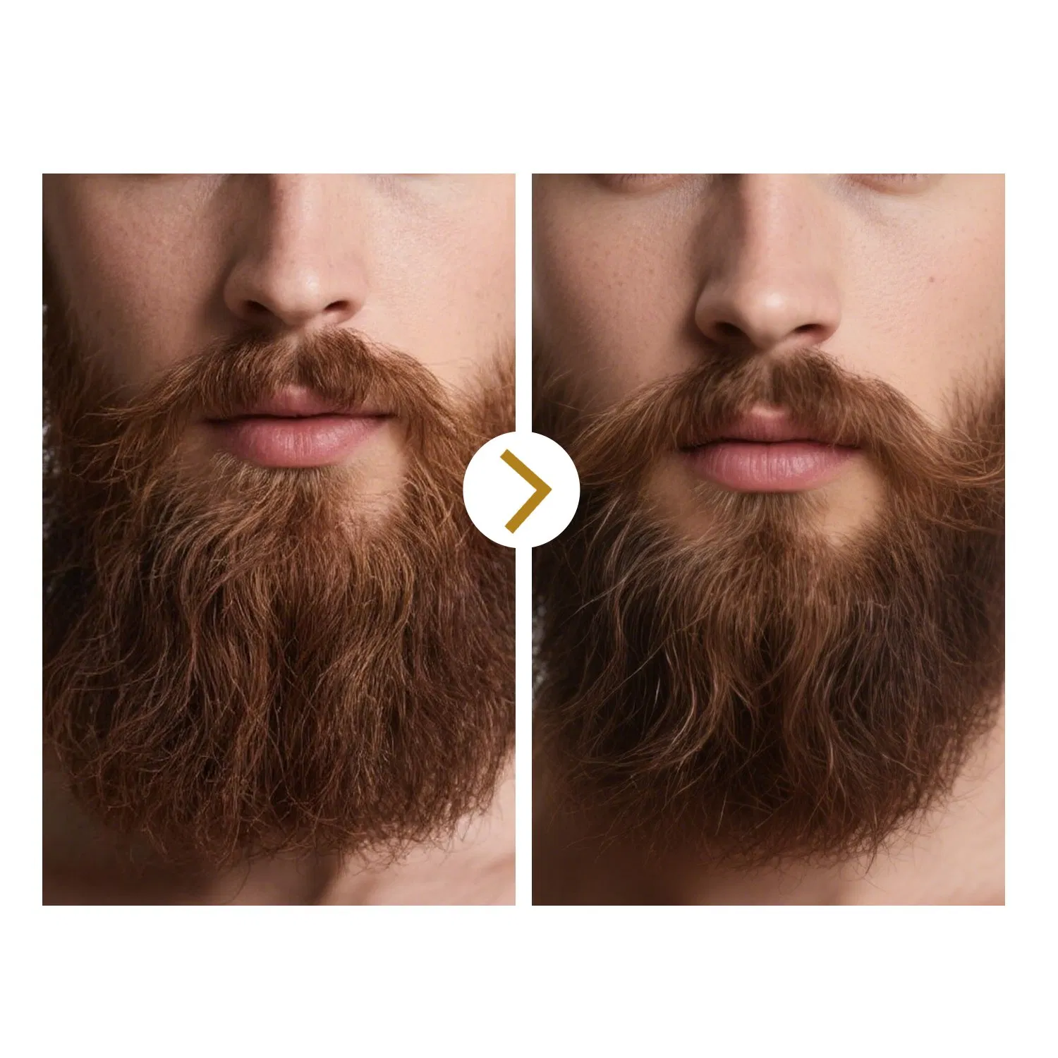 Qbeka Fast Absorbing Beard Oil for Men - Sensitive Skin Friendly Beard Nourisher