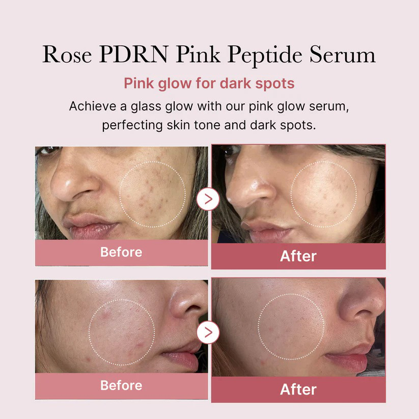 High Concentration Pdrn Pink Peptide Serum Niacinamide 30ml Korean Facial Skincare Factory