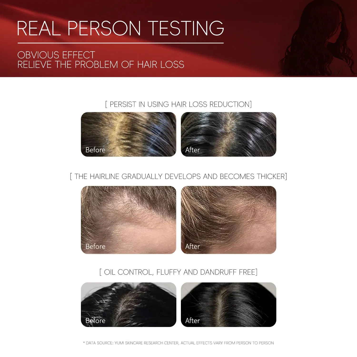 Youthful Private Label Ginger Anti Hair Loss Hair Growth Shampoo