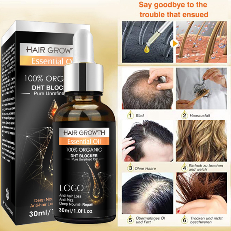 Natural Reduce Hair Loss Unchoke Pores Moisturizing Frizz Hair Growth Essential Oil