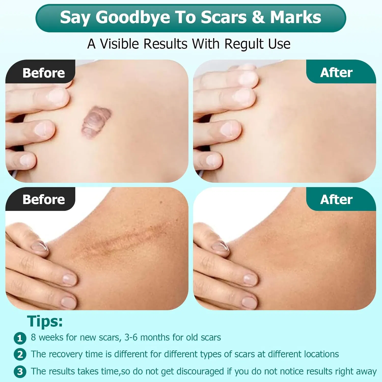 Beauty Cosmetics Skin Care Scar Cream C-Section Stretch Marks Advanced Scar Gel