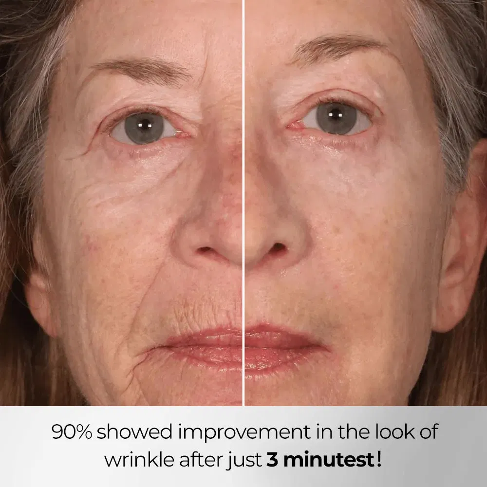Lift Eye Cream Anti Wrinkle Firming Brightening Eye Bags Dark Circles Removal