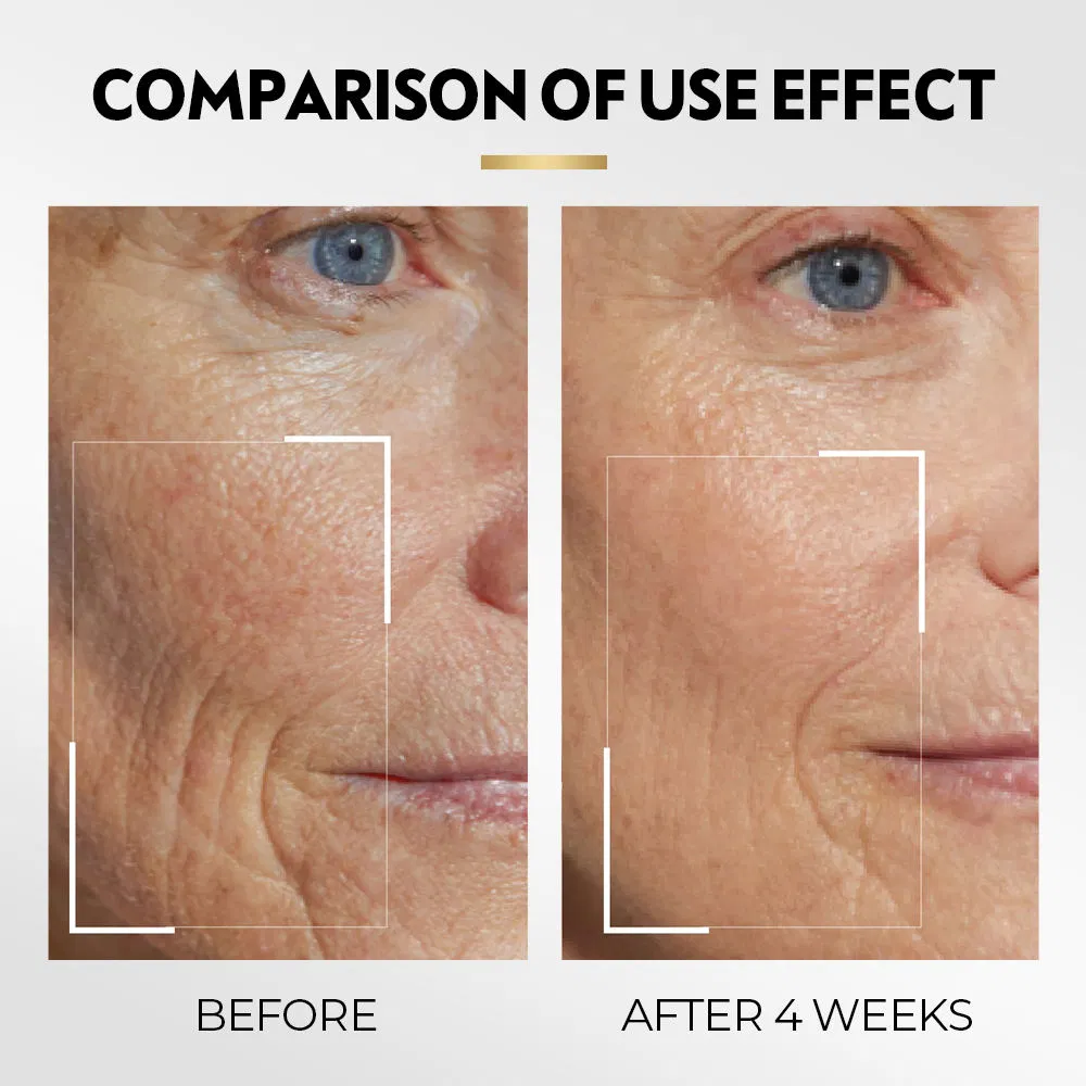 Anti Aging Remove Wrinkles Dark Circles Brightening Under Eye Cream