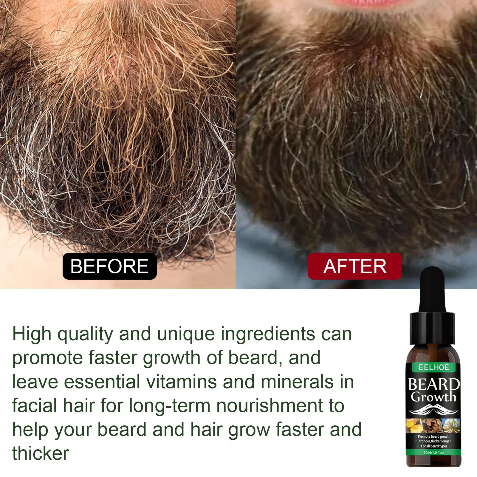 OEM Luxury Private Label Professional Natural Ginger Organic Mens Beard Growth Oil Hair Growth 30ml