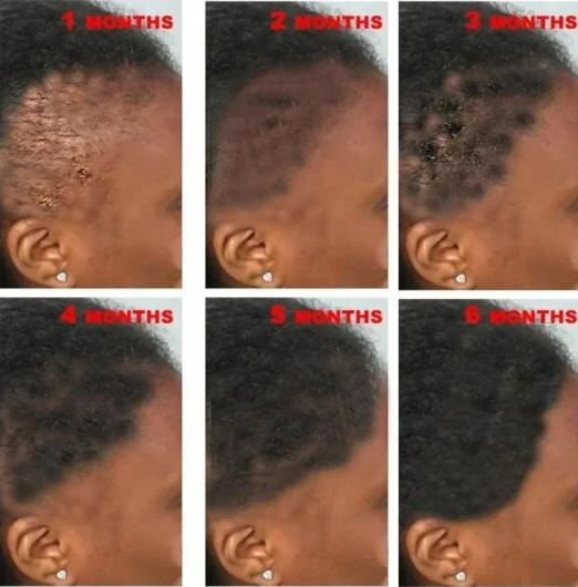 Private Label Natural Rosemary Serum Nourishing Scalp Care Loss Treatment Hair Regrowth Growth Oil