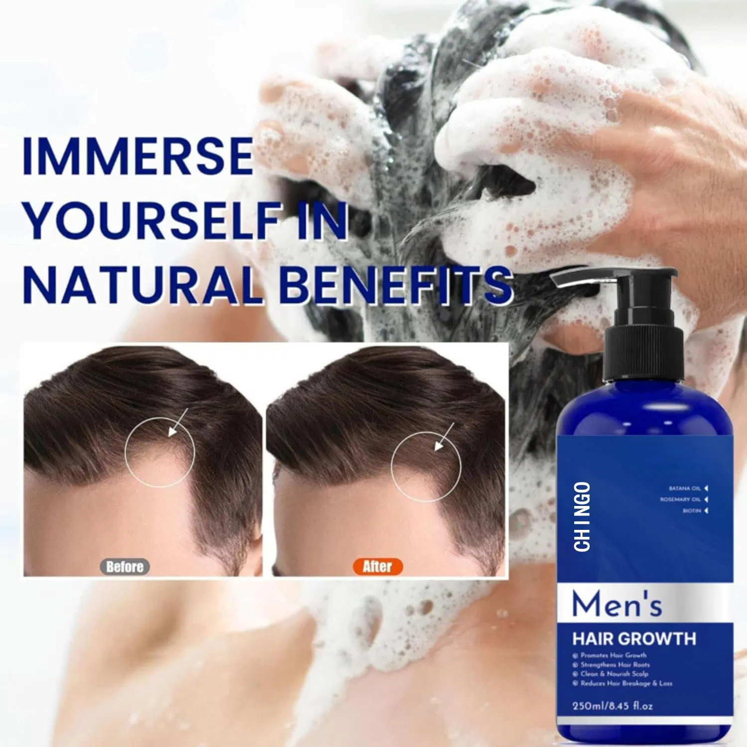 Sulfate-Free Hair Growth Shampoo Prevents Shedding Thickens Fine Hair