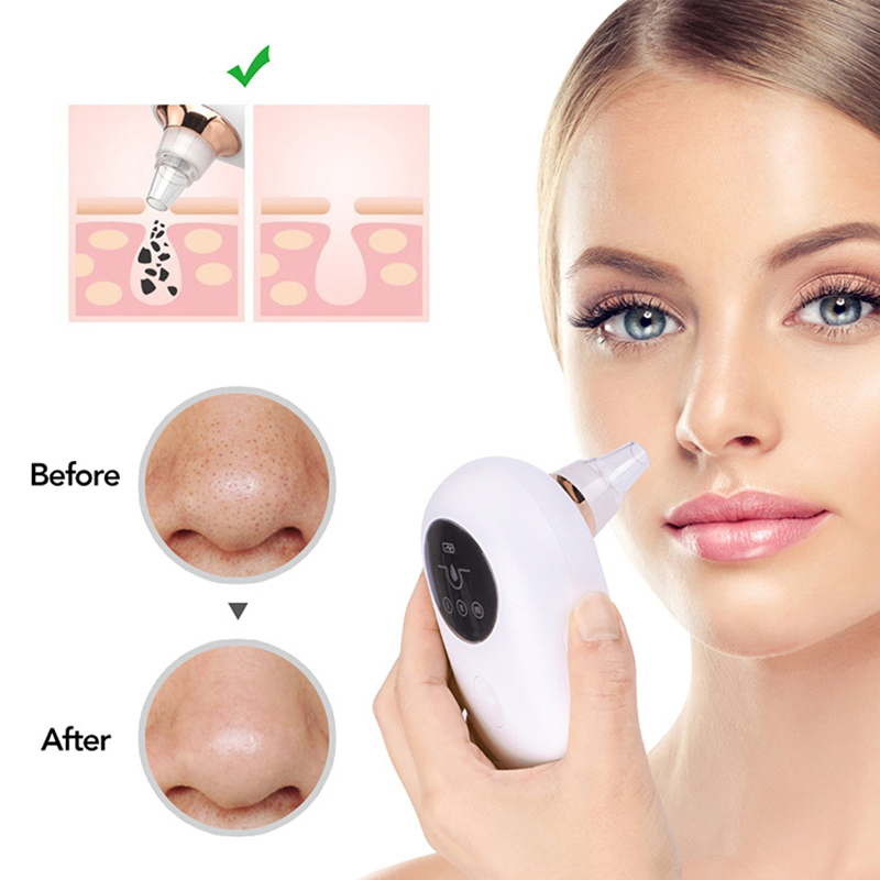 Home Beauty Instrument Electric USB Charging Facial Acne Pore Cleaner Machine Comedo Suction Remover Vacuum Blackhead Removal