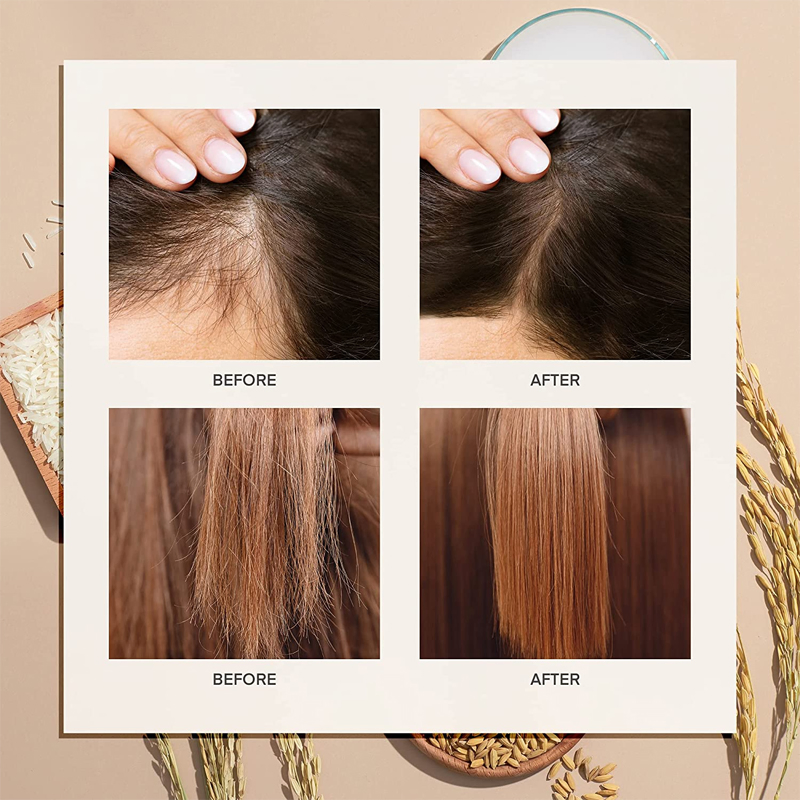 Hair Care Treatment Serum Fermented Rice Water Hair Growth Oil Nourishing Spray