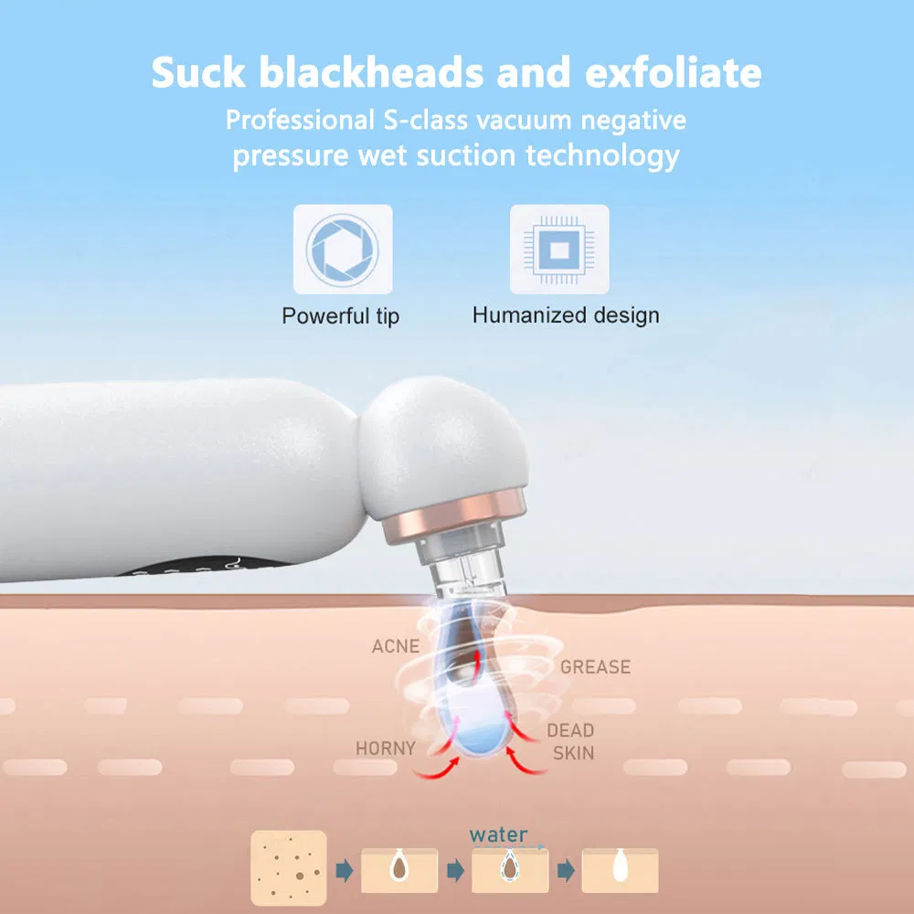 Electric Blackhead Suction Tool with Steam Bubble Technology