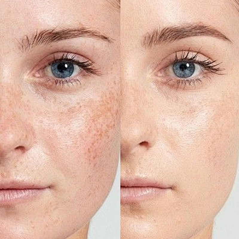 Private Label Vitamin C 20% Pearl Bright 7 Days Dark Spot Corrector Face Stronger Skin Whitening Serum