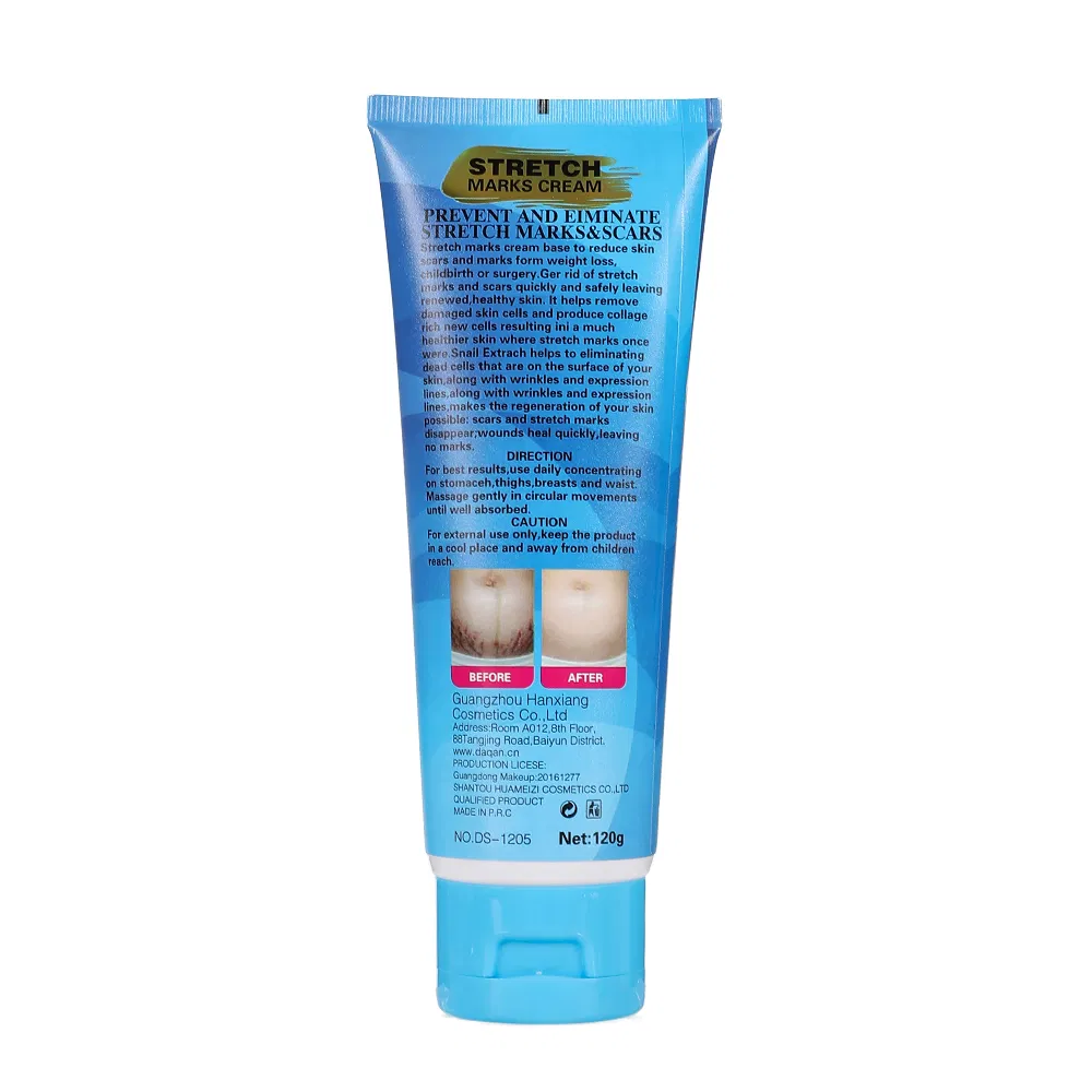 Factory Sales Moisturizing Natural Snail Extract Nourishing Eliminate Stretch Mark Skin Repair Cream
