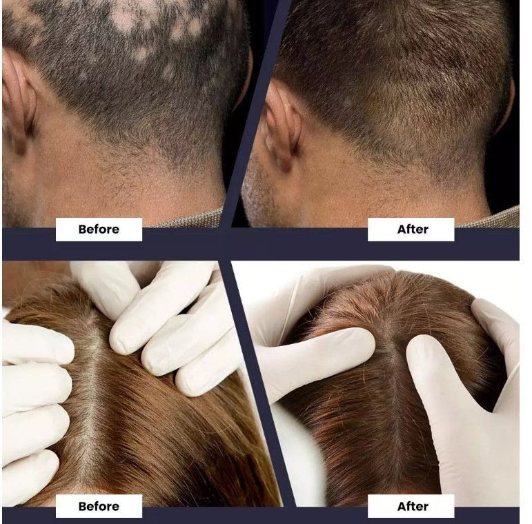 OEM ODM Wholesale Organic Anti Loss Hair Growth Serum Fuller Thicker Healthy Natural Biotin Hair Growth Serum