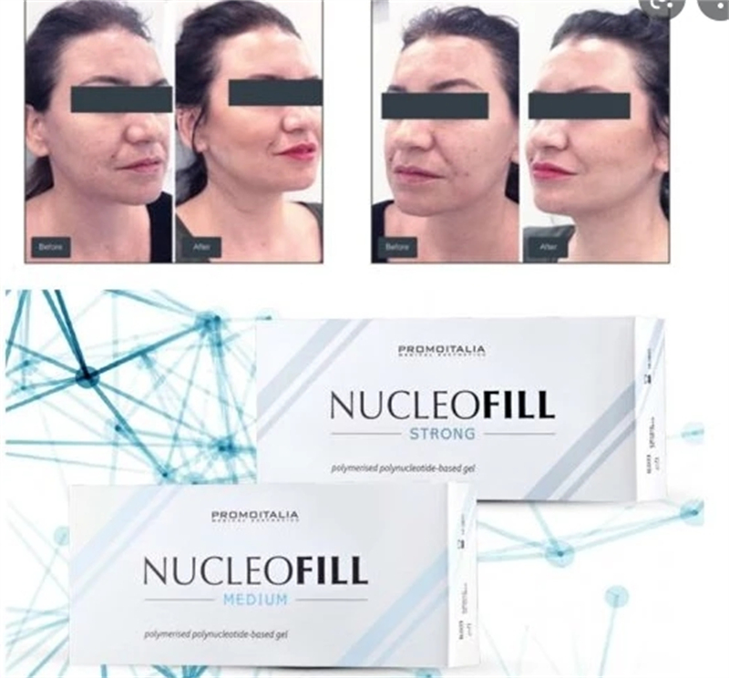 Nucleofill Face Lifting Filler Collagen Stimulating Agent Profhilo H+L