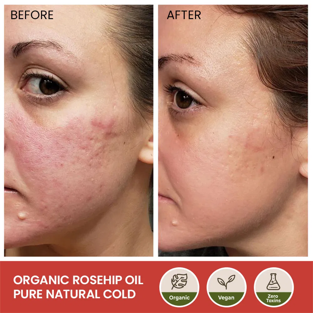 Organic Cold Pressed Face Body Hair Rosehip Seed Oil Nourishing Moisturizing