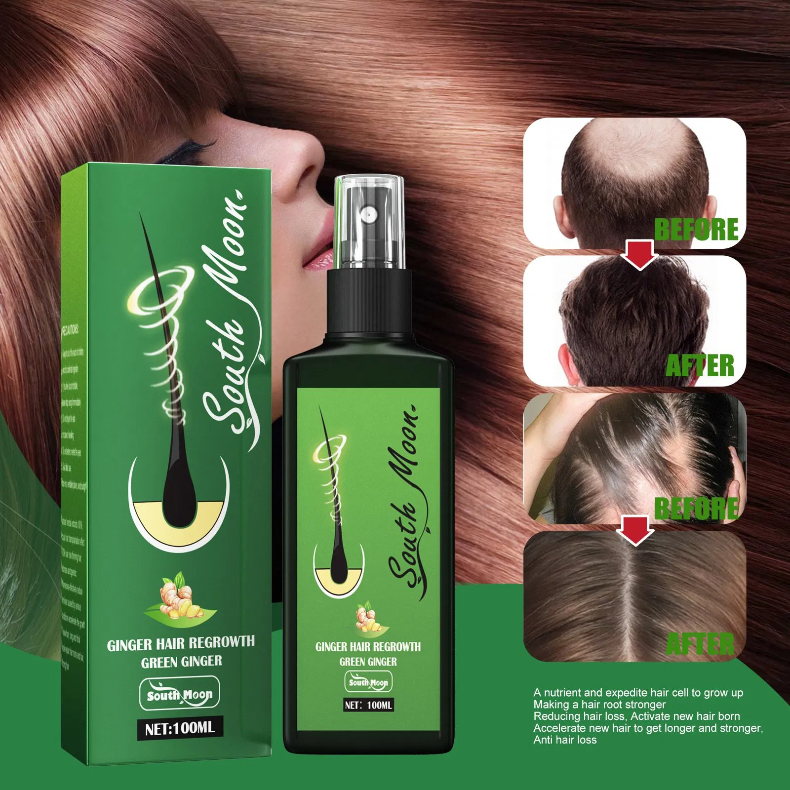 2024 Hair Growth Serum Private Label Ginger Hair Regrowth Redensyl Hair Growth Serum