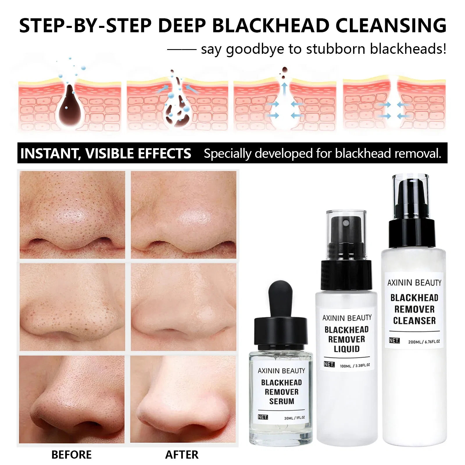 Beauty Cosmetics Skin Care Balances Oil Minimizes Pores Blackhead Remover Three-Piece Set