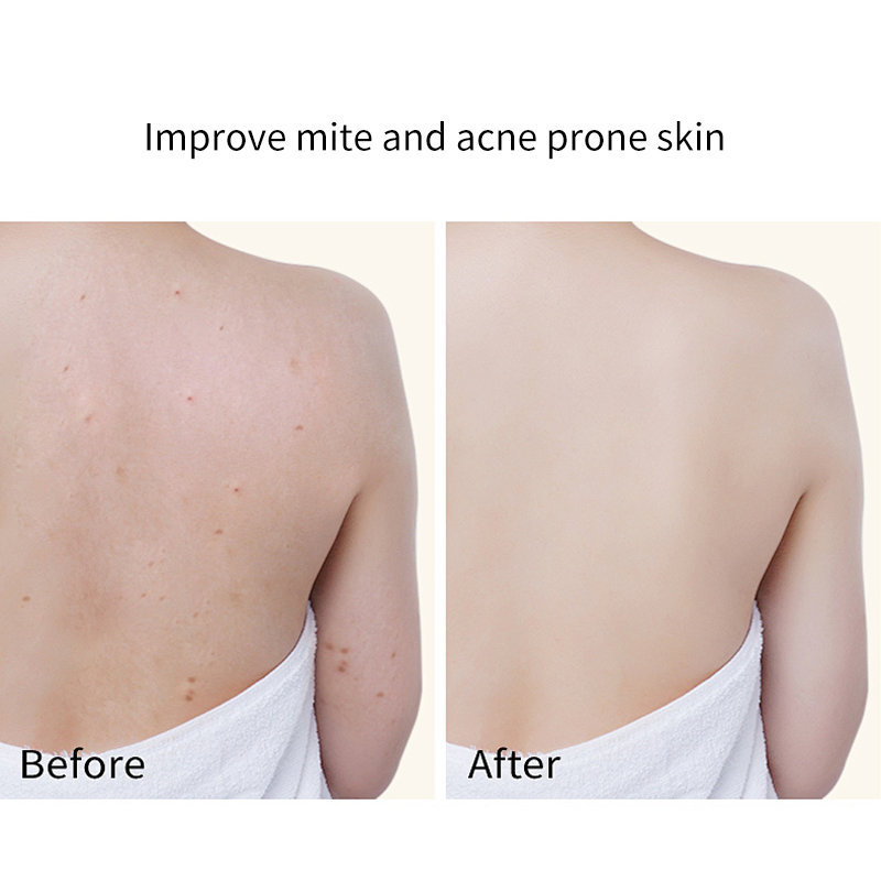 Ditong 300ml Skin Moisturizing Exfoliating Shower Gel Acne Remover Deep Cleaning Shower Gel for Brighter Softer and Smoother
