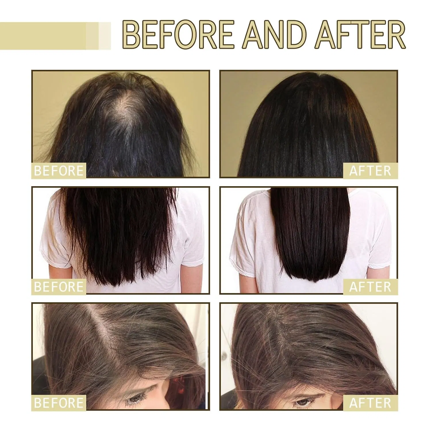 Private Label Natural Organic Rosemary Hair Growth Oil Hair Regrowth Treatment Scalp Care Massage Hair Scalp Oil