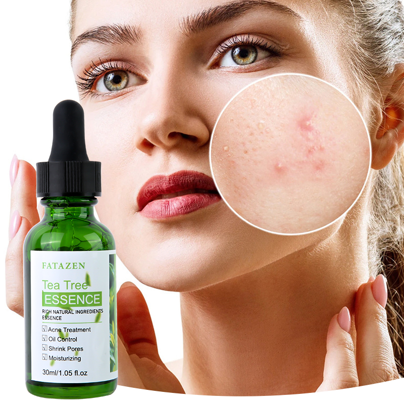 Brightening Green Tea Tree Anti-Acne Serum Whitening Hydrating Skincare Facial Essence