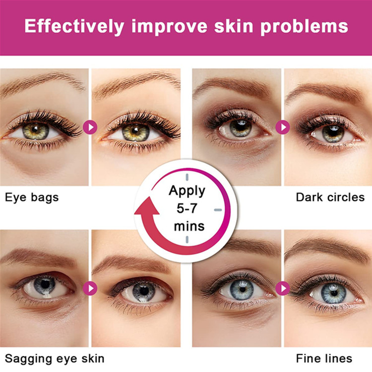 OEM/ODM Dark Circles Treatment Snail Collagen Eye Mask