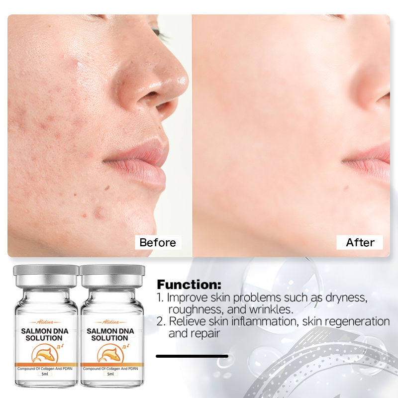 Private Logo Salmon DNA Pdrn Peptides Serum Salmon Sodium DNA Micro Infusion Solution Cell Recovery Barrier Strengthening Pdrn Skin Booster