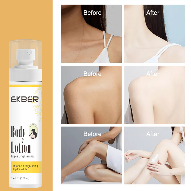 Ekber Skin Whitening Body Lotion Private Label Brightening Body Lotion Organic Body Lotion Cream