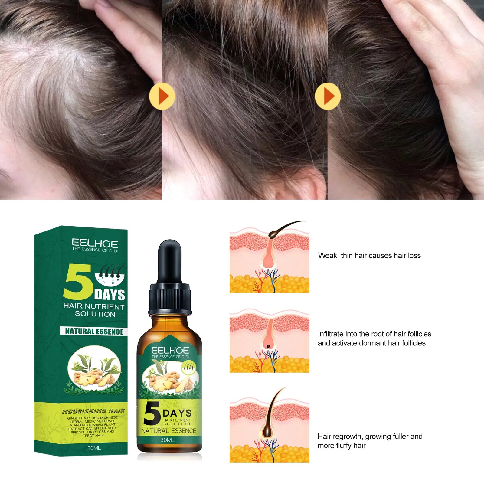 Wholesale Hair Growth Serum Anti Hair Loss Repairing Ginger Vitamin Care Essential Hair Growth Oil